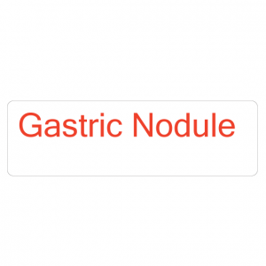 gastric nodule icd 10